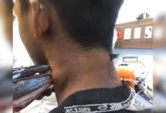 Pez espada atraviesa el cuello de un pescador en Indonesia