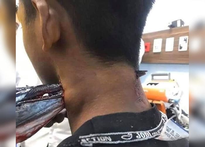 Pez espada atraviesa el cuello de un pescador en Indonesia