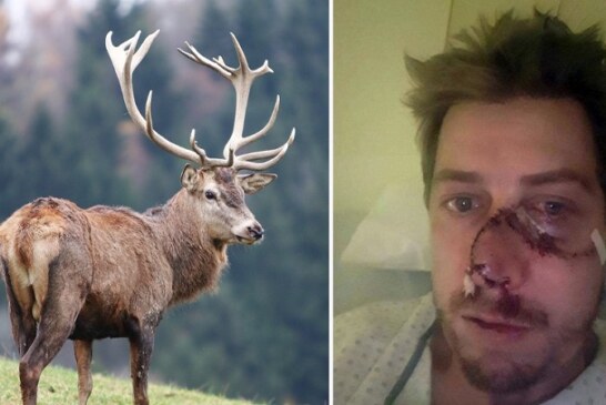 Francia: Ciervo ataca a un cazador y le deja una tremenda cicatriz en su cara